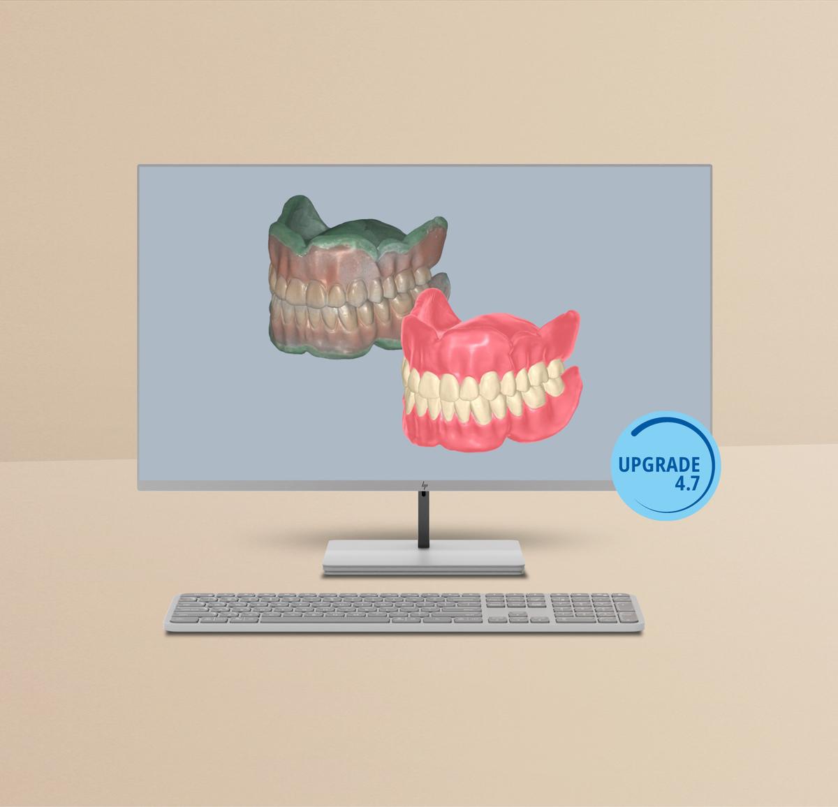 Up-to-date with the latest Ceramill Software Upgrade