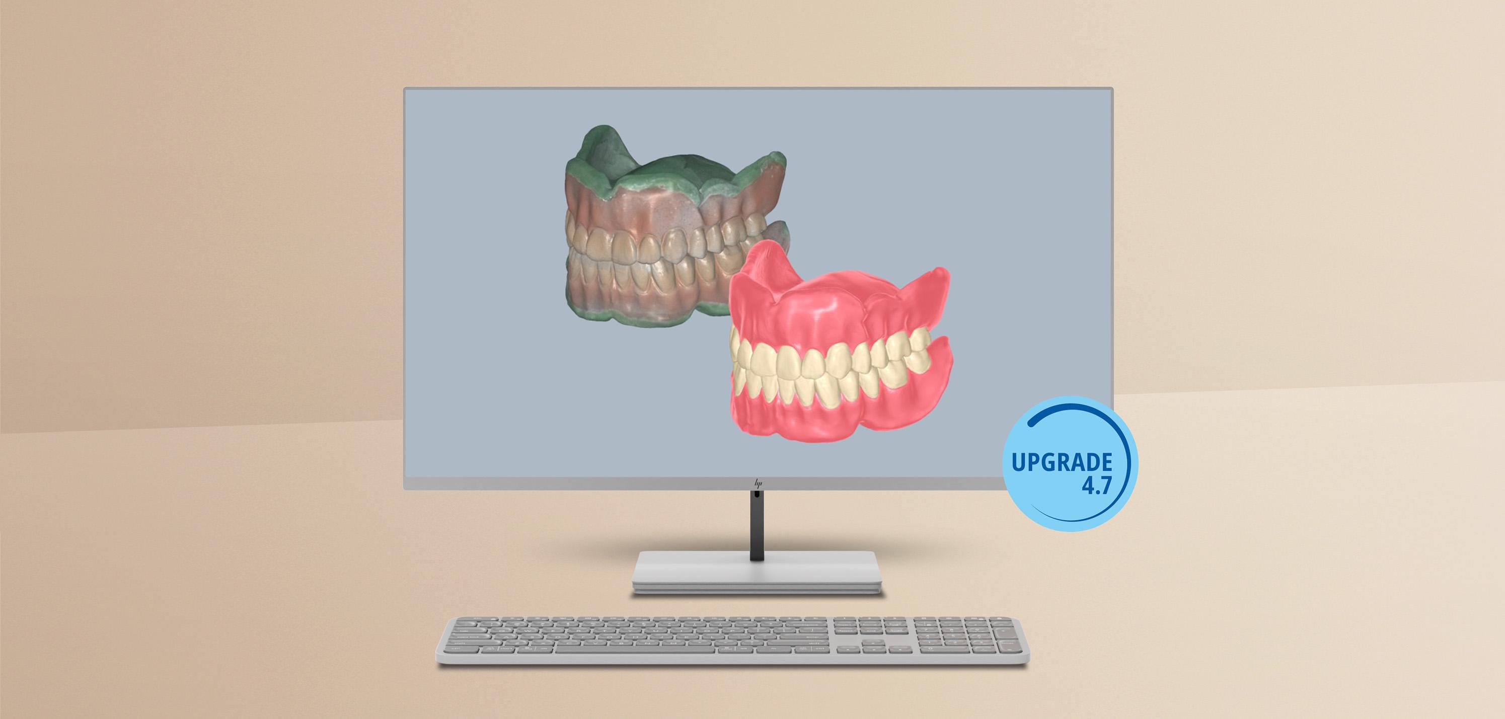 Up-to-date with the latest Ceramill Software Upgrade
