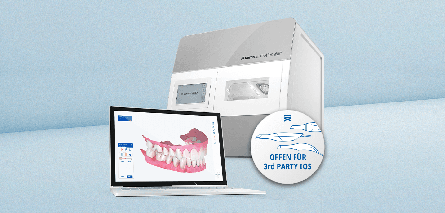 Same-Day-Dentistry ganz einfach mit bestehendem Intraoralscanner