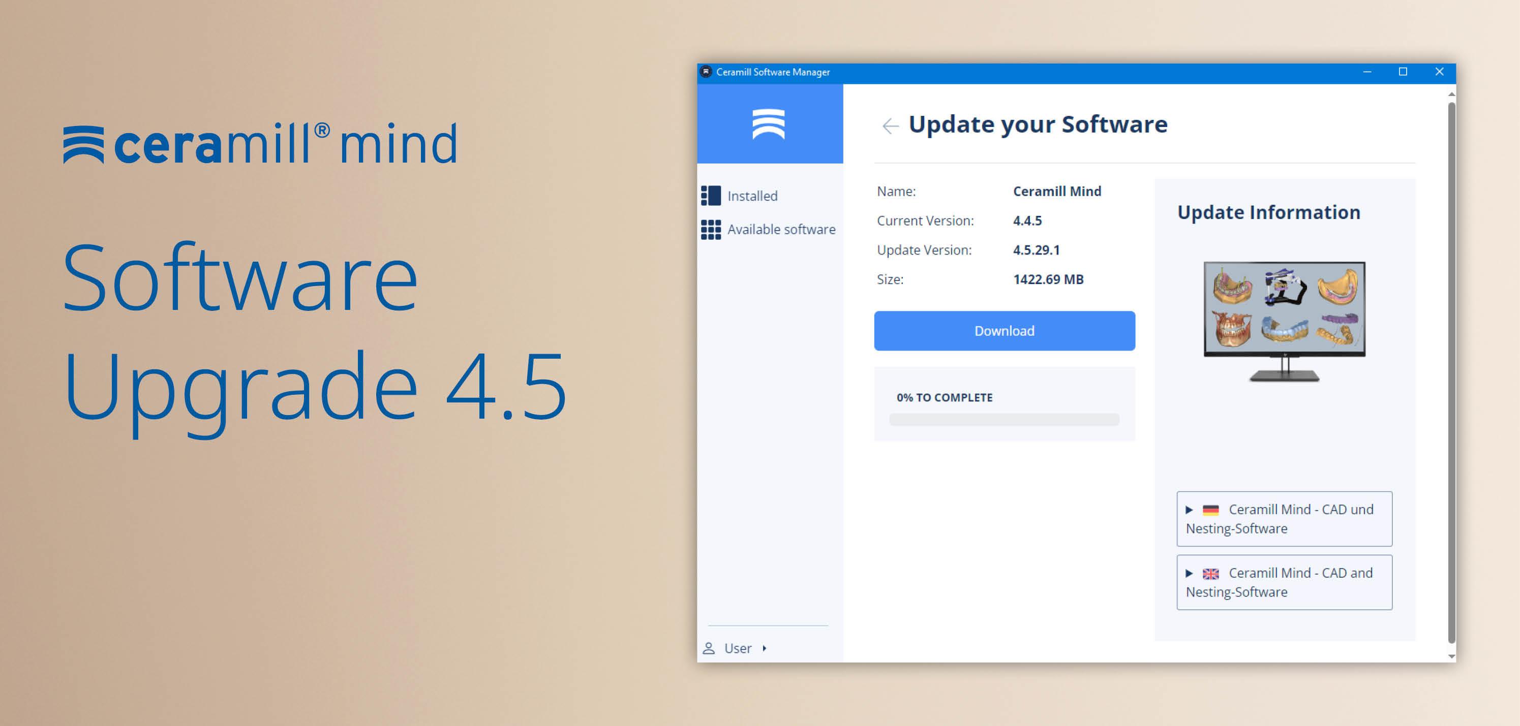 Ceramill Software-Upgrade 4.5 verfügbar