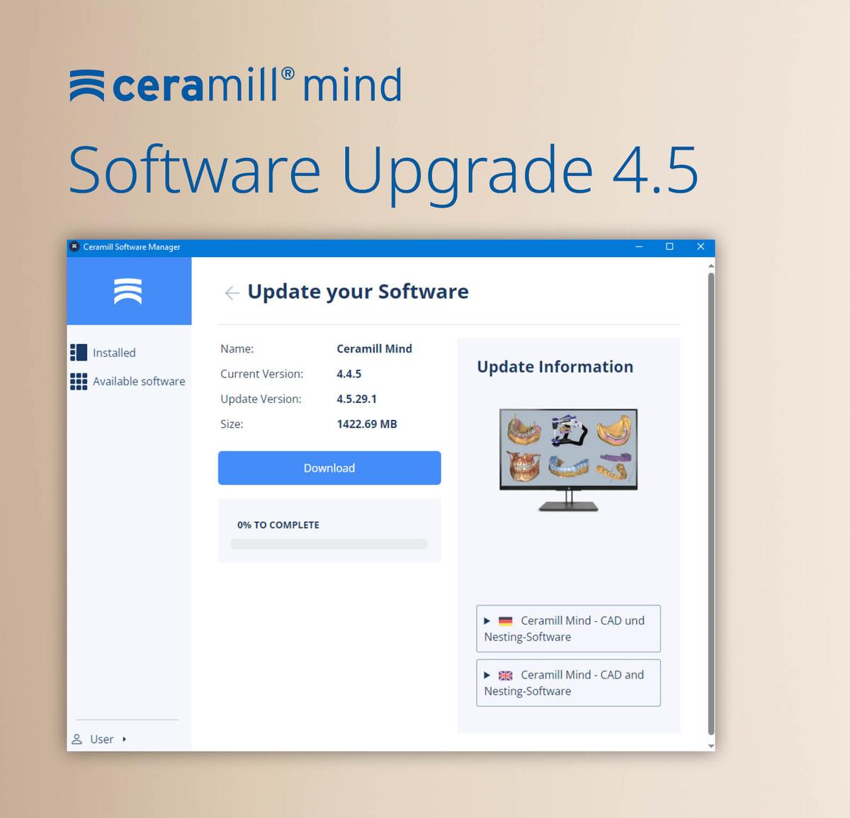 Ceramill Software-Upgrade 4.5 verfügbar