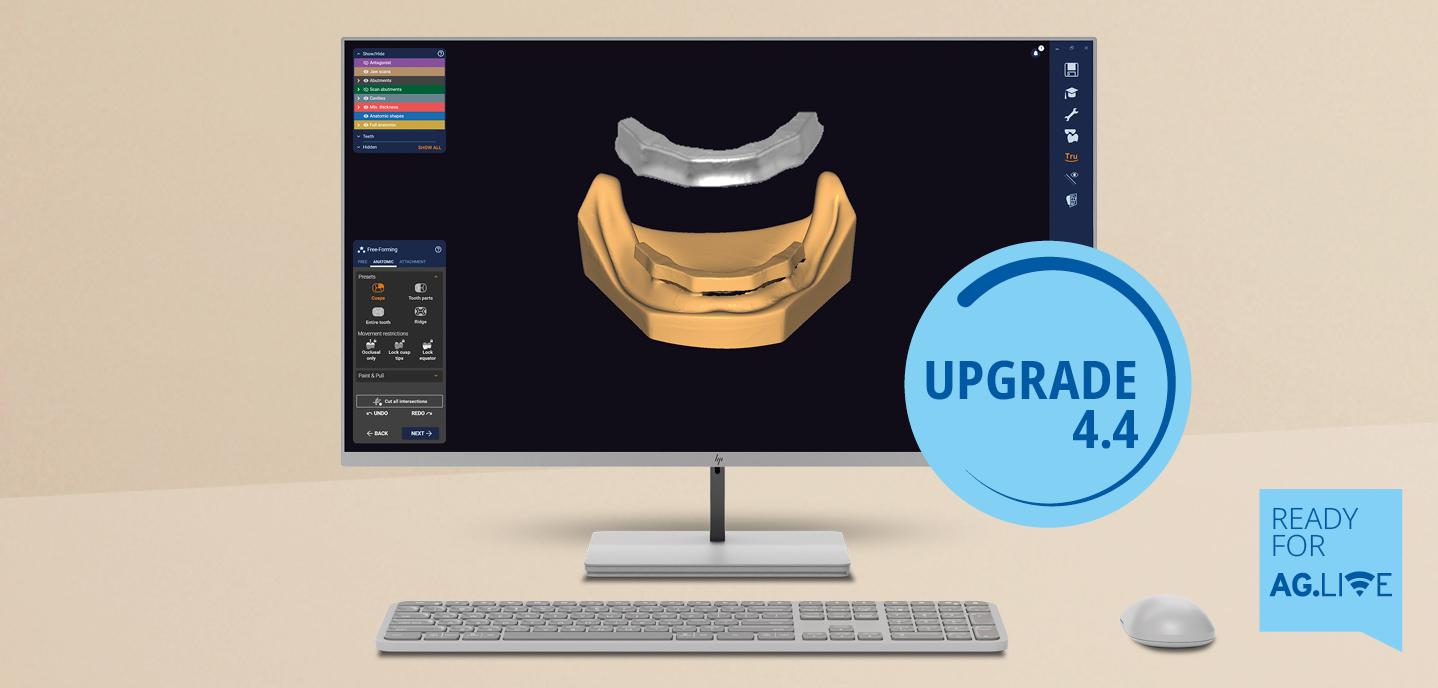 Now available: Ceramill Software Upgrade 4.4 - simple workflows and new indications in the Ceramill workflow