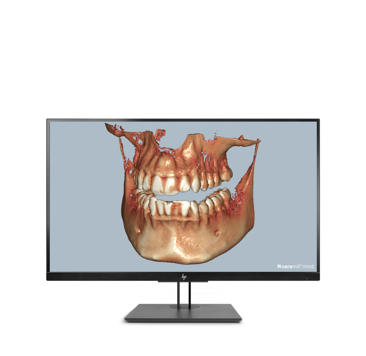 Ceramill Dicom-Viewer