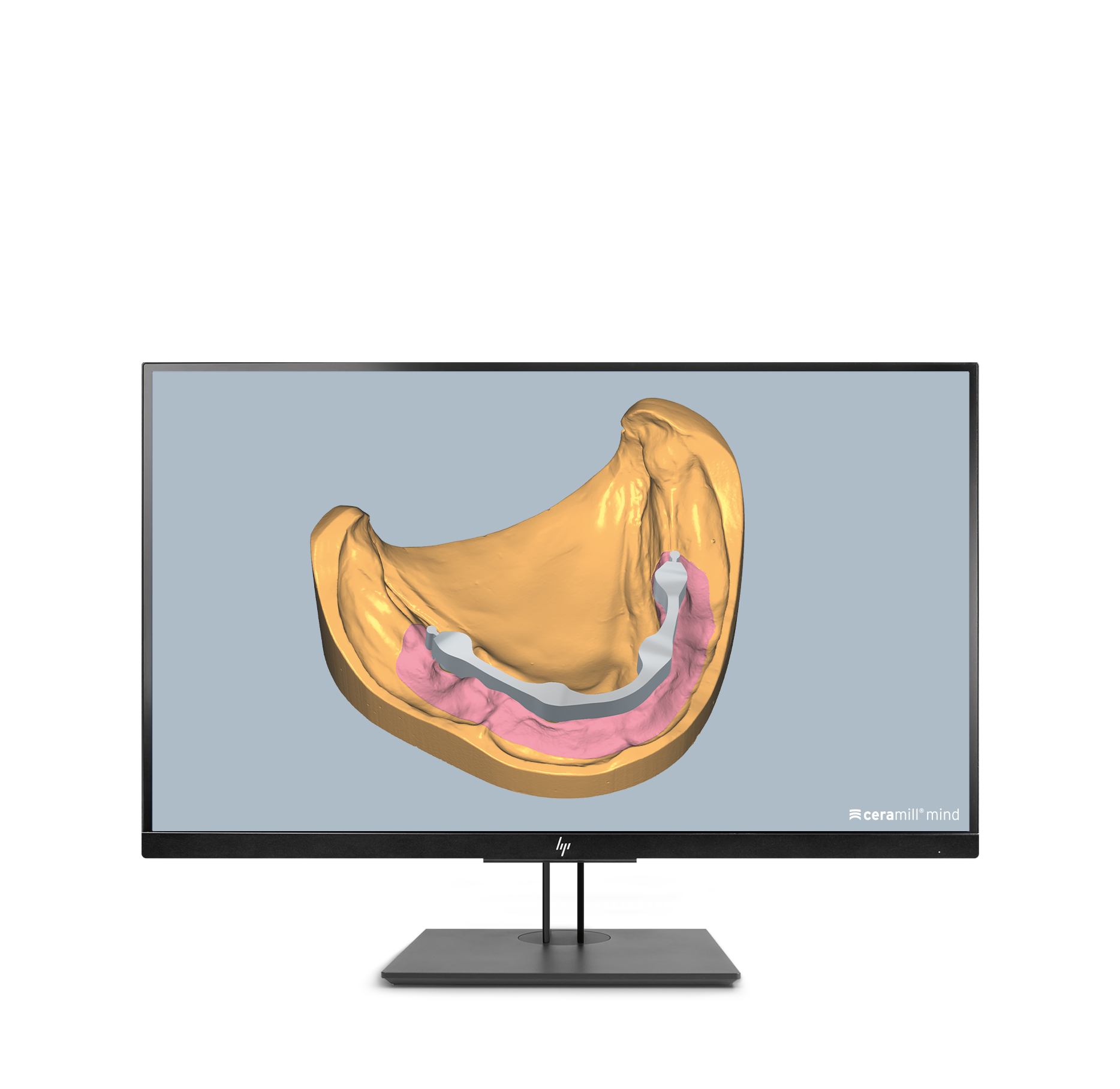 Ceramill M-Bars