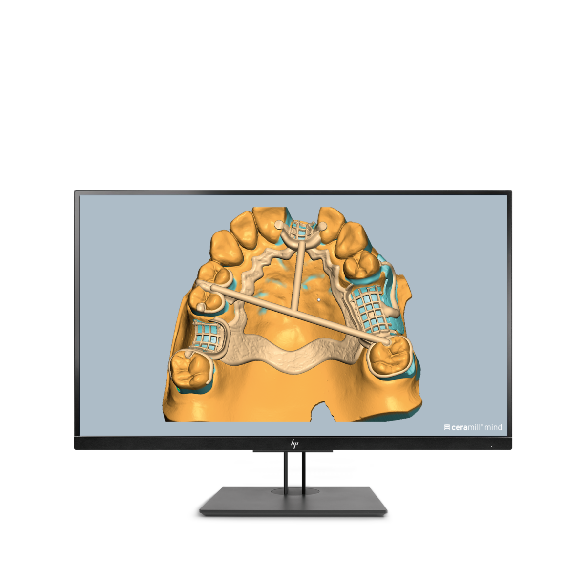 Ceramill M-Part