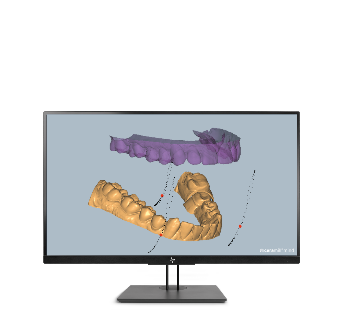 Ceramill M-Pass