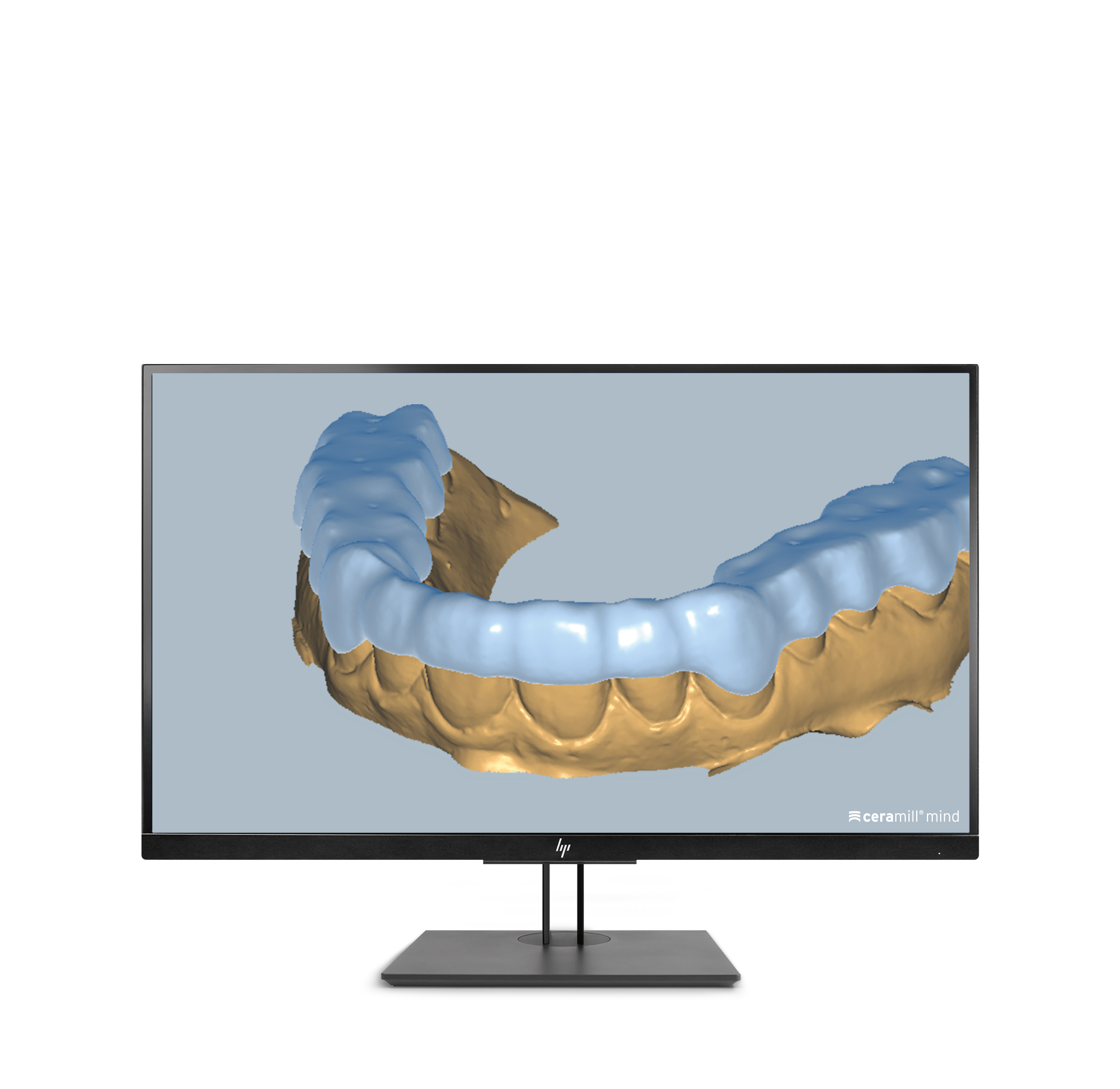 Ceramill M-Splint