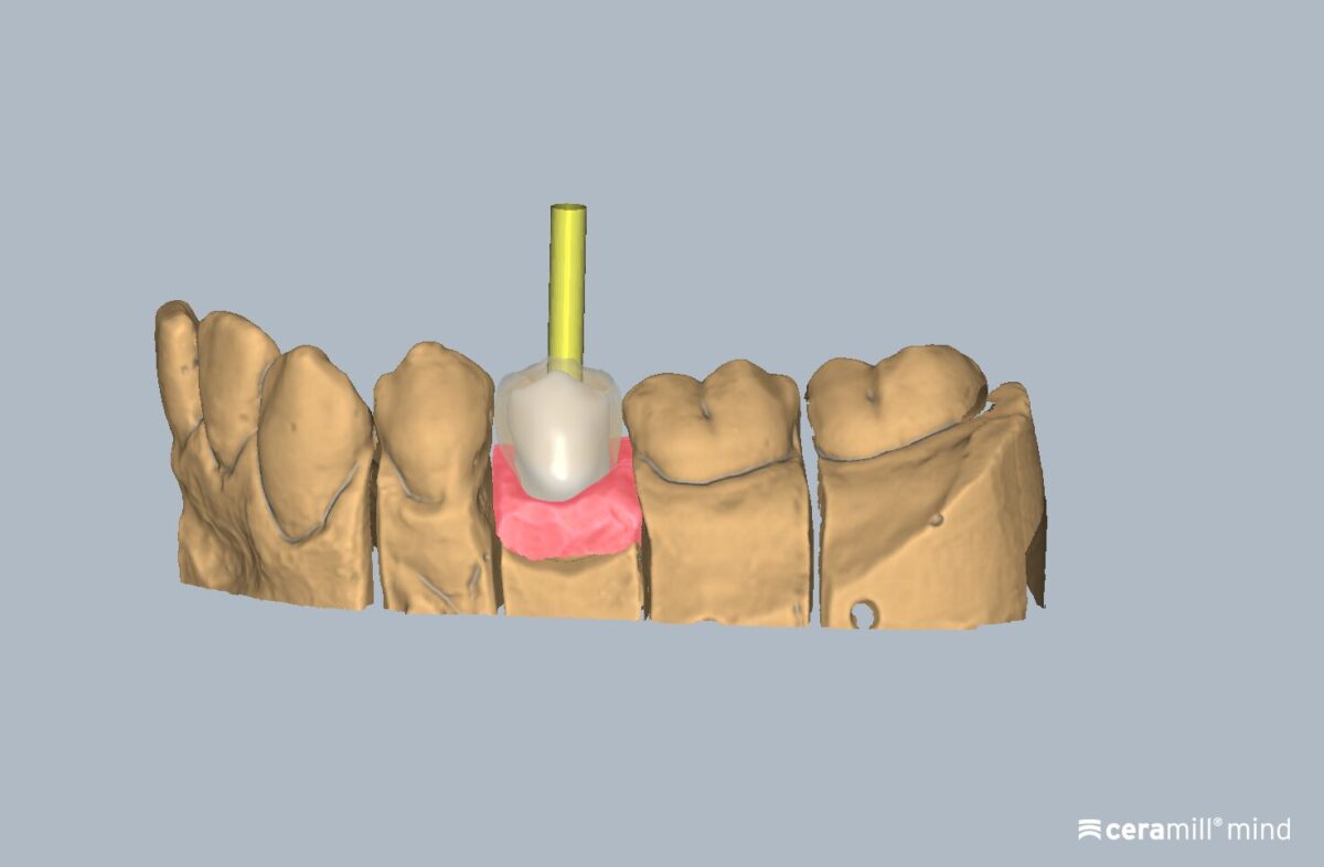 Ceramill M-Plant