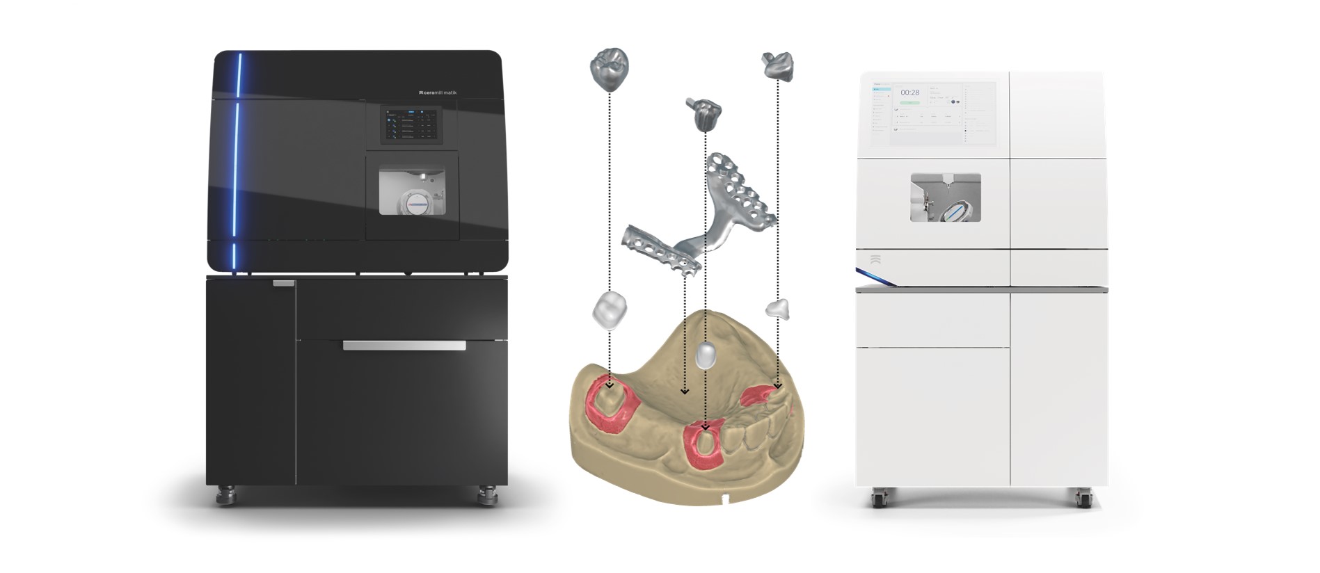 Ceramill Mind: Fräsen von CoCr-Sekundärteleskopen in der Ceramill Matik und Ceramill Matron