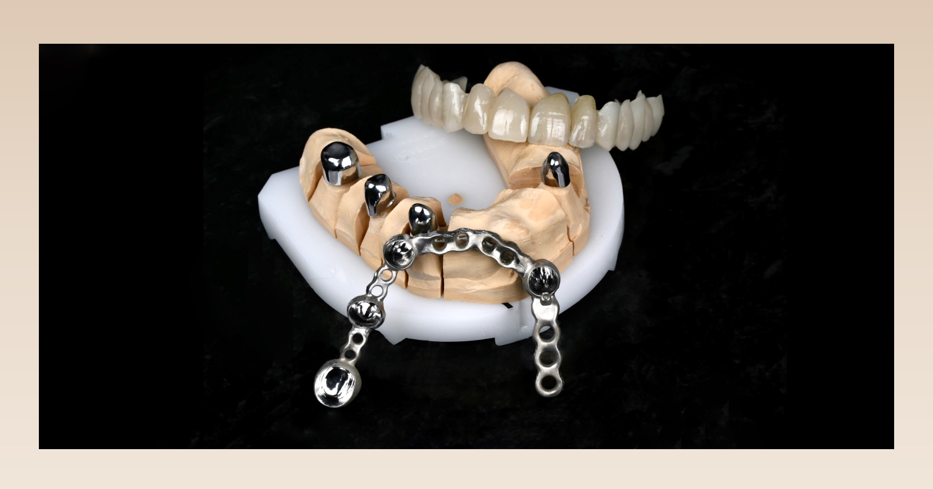Ceramill Mind: Sekundärteleskope aus Ceramill Sintron