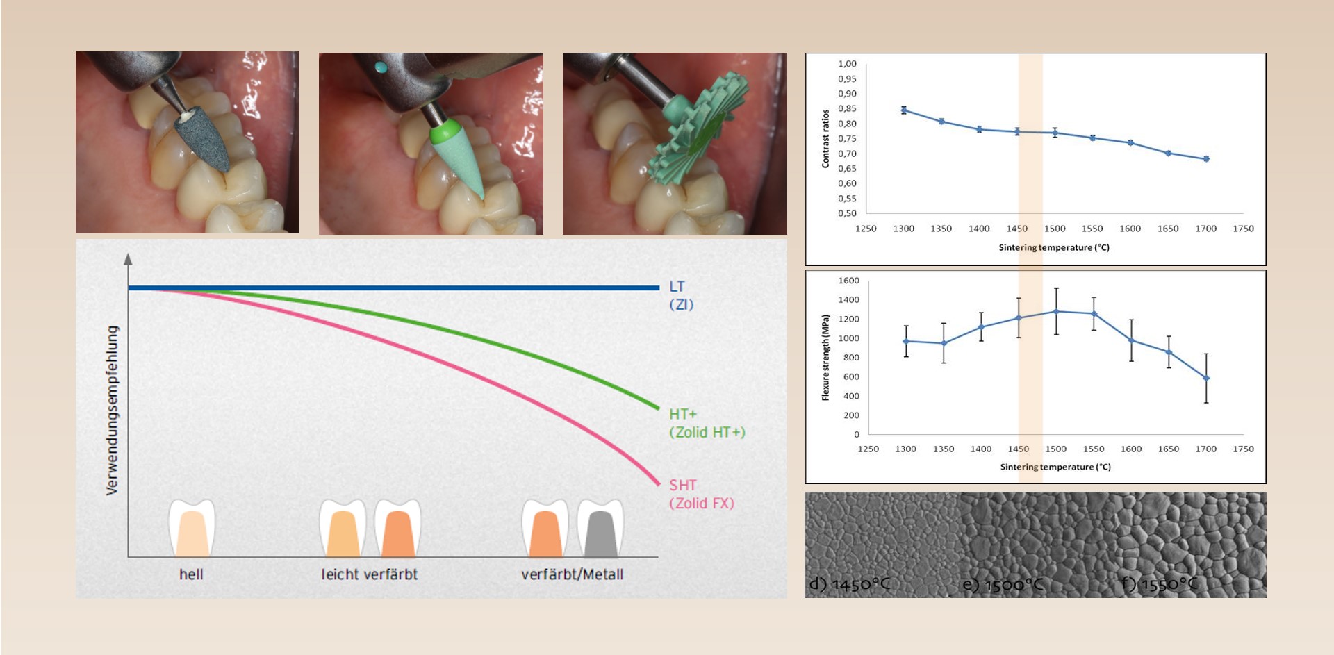 Esthetic Management: Material Management Zirkoniumdioxid ZA