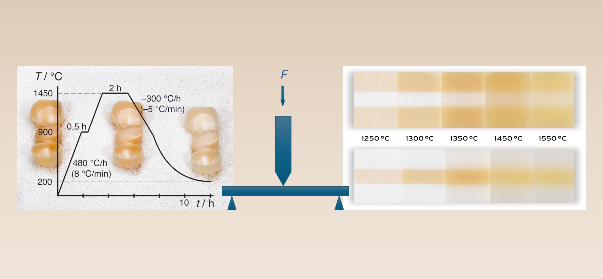 Esthetic Management: Material Management Zirkoniumdioxid