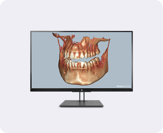 Banner Ceramill Mind Softwaremodul Dicom Viewer