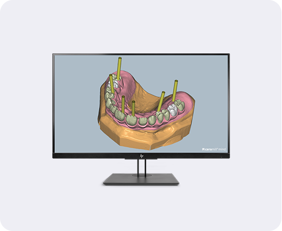 Banner Ceramill Mind Softwaremodul M-Gin