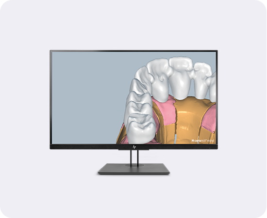 Banner Ceramill Mind Softwaremodul M-Plant