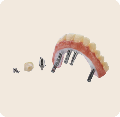 Banner Implant Prosthetics