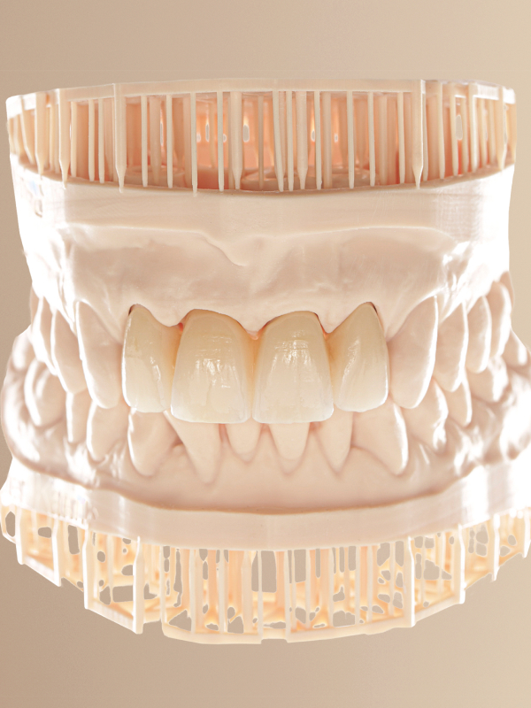 Ceramill XTP Model