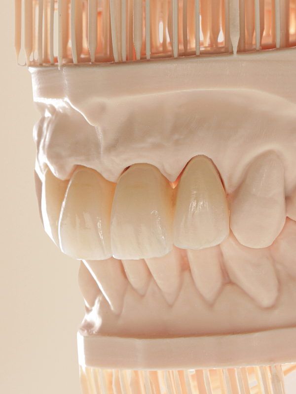 Ceramill XTP Material