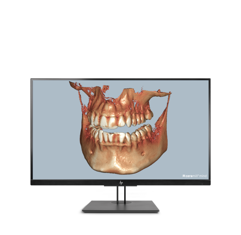Ceramill Dicom-Viewer
