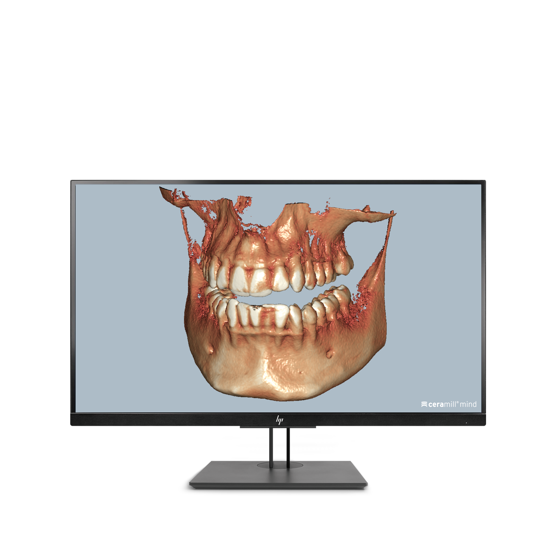Ceramill Dicom-Viewer