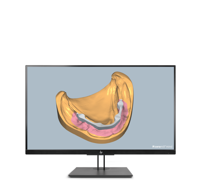 Ceramill M-Bars