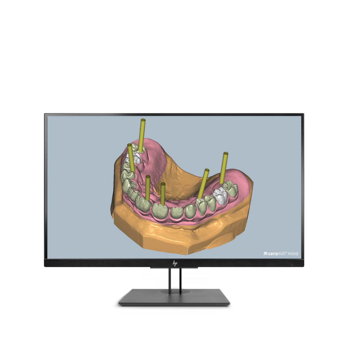 Ceramill M-Gin