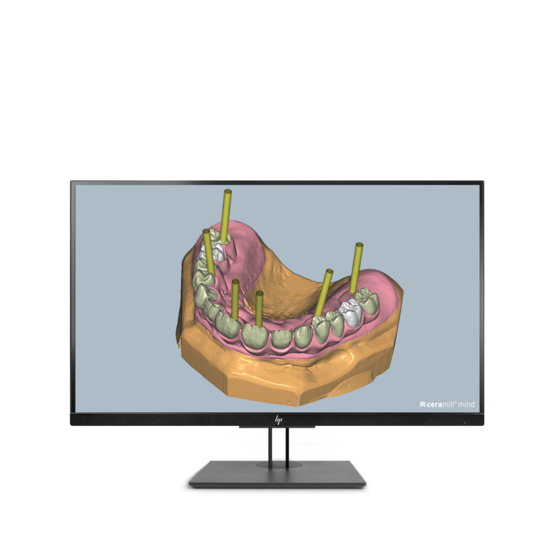 Ceramill M-Gin