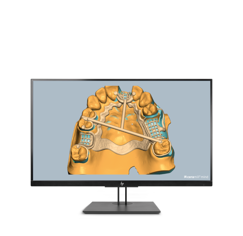 Ceramill M-Part