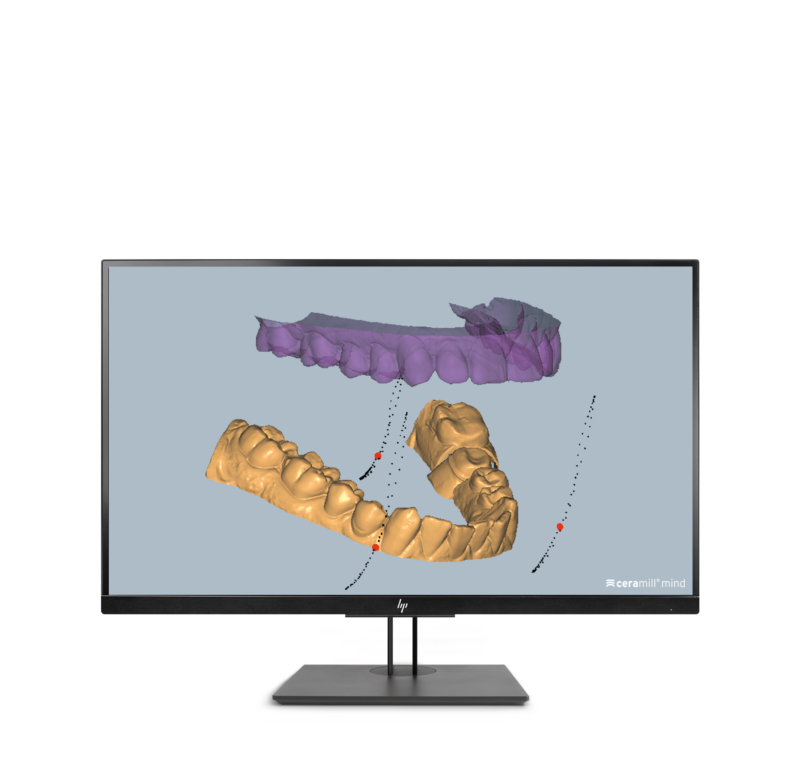 Ceramill M-Pass