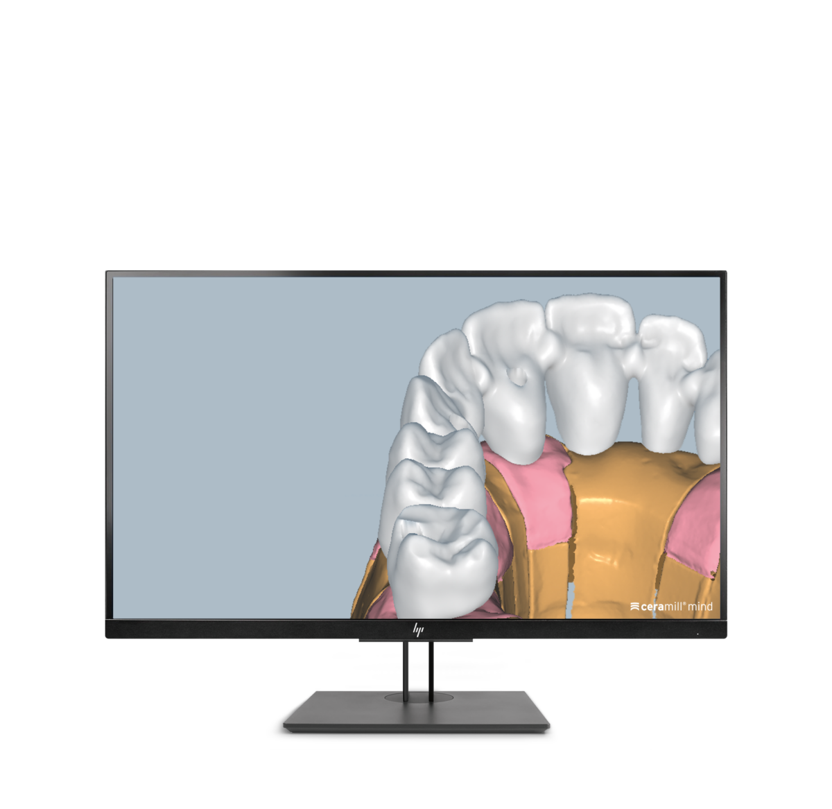 Ceramill M-Plant