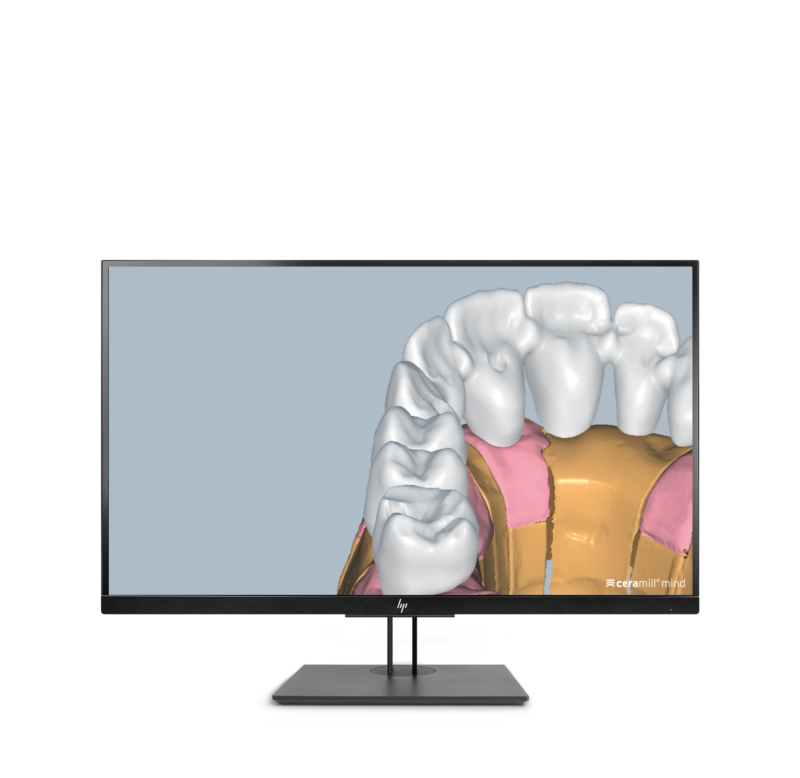 Ceramill M-Plant
