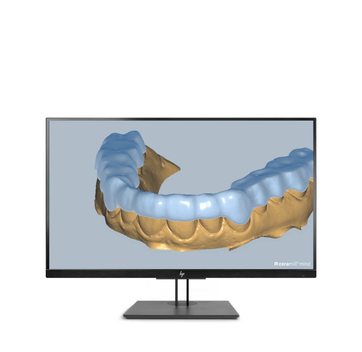 Ceramill M-Splint