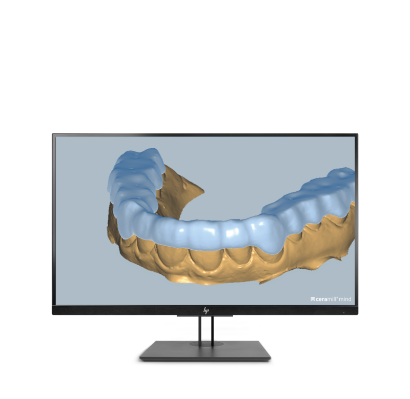 Ceramill M-Splint