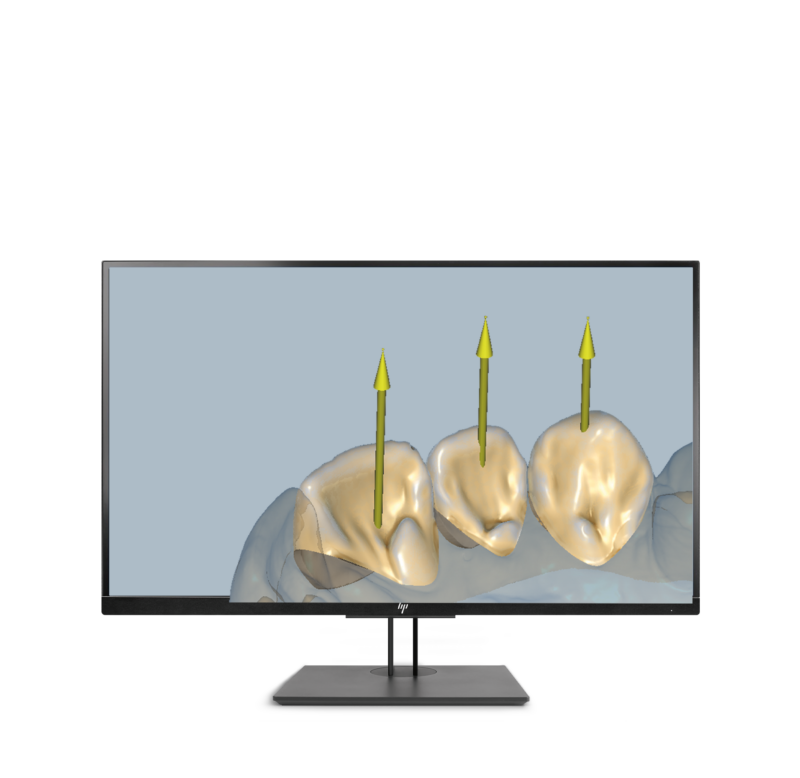 Ceramill Microshell