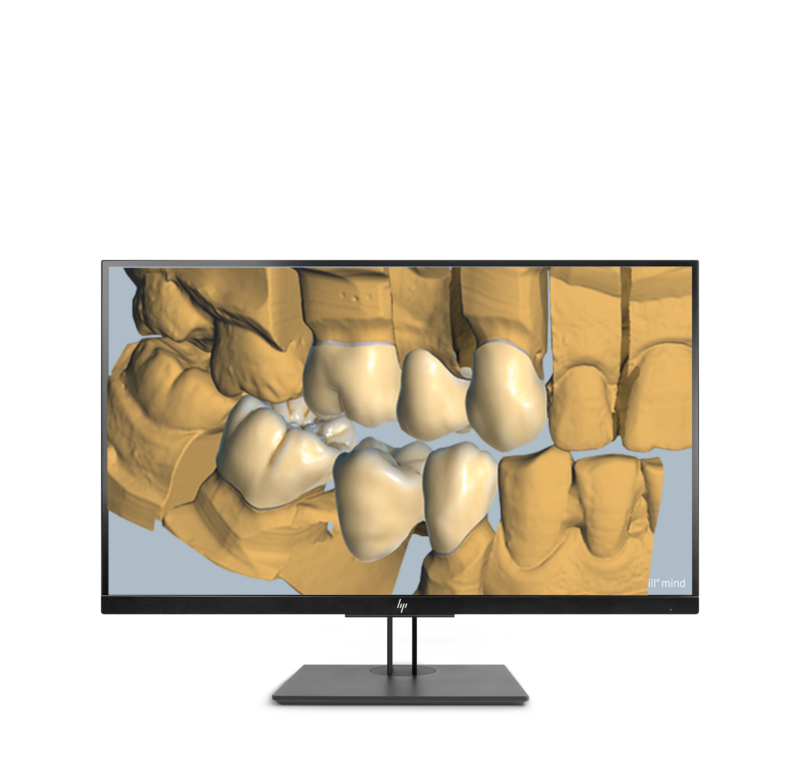 Ceramill Trusmile