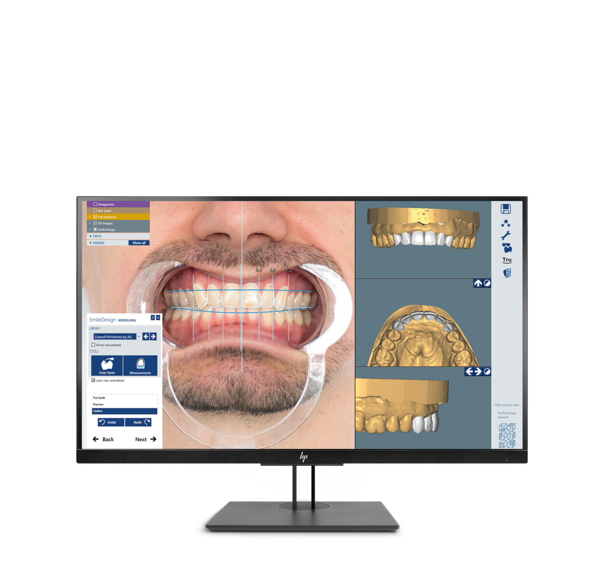 Ceramill M-Smile
