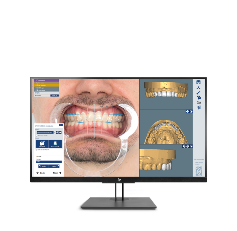 Ceramill M-Smile