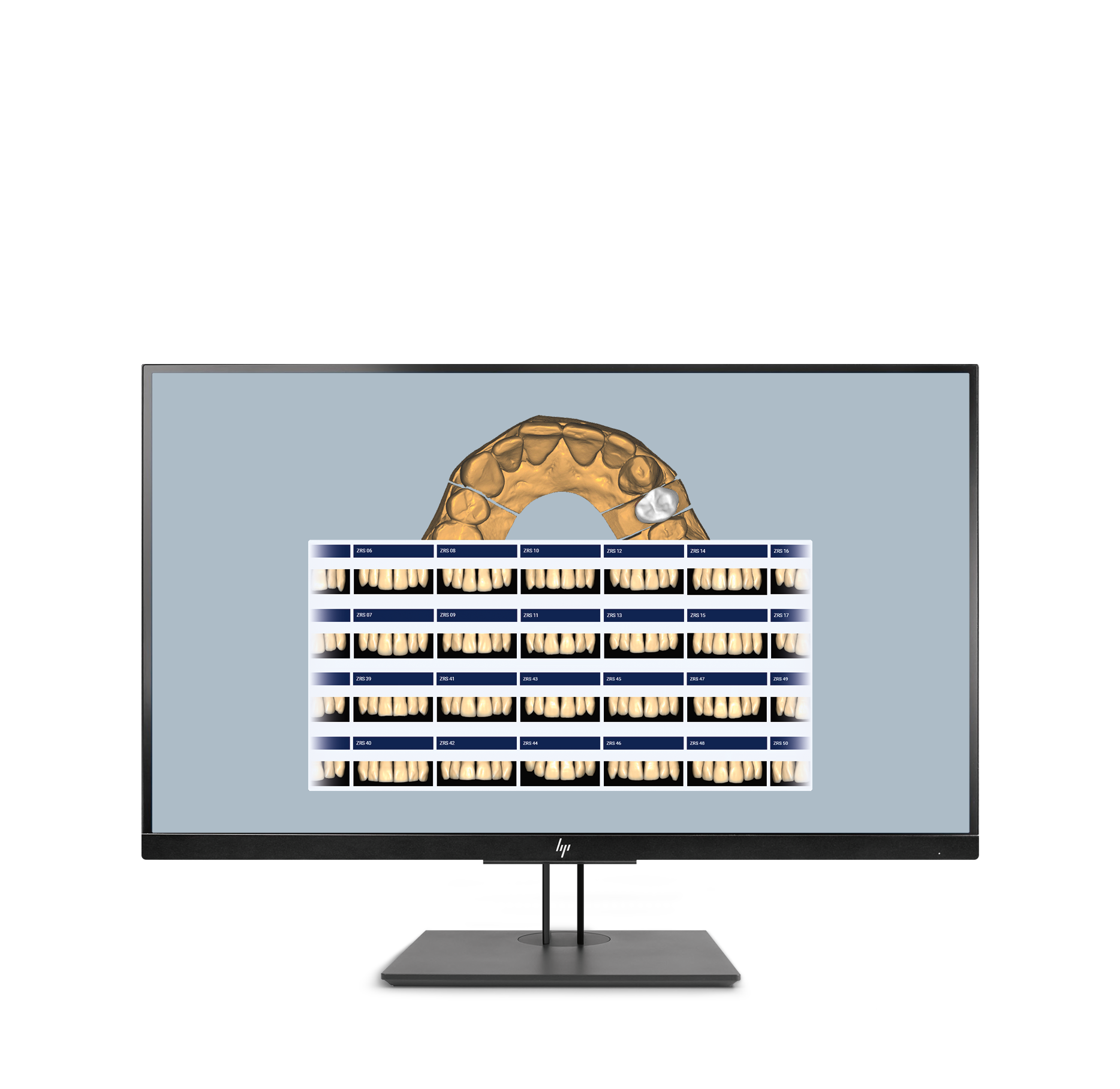 Ceramill-Mind-Screen-2023-ZRS- 