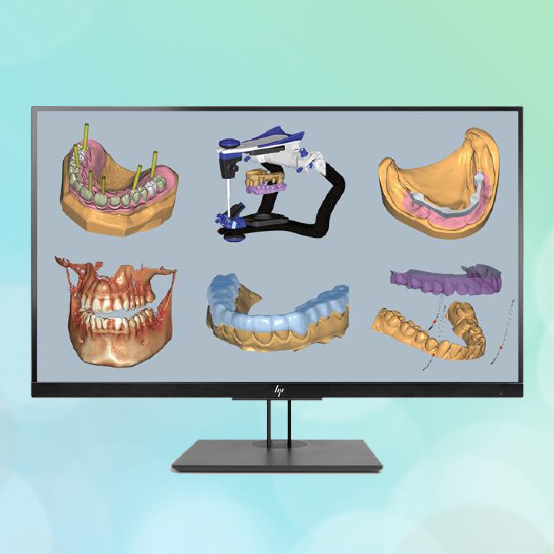 All on X: Where Digital &amp; Analog Meet