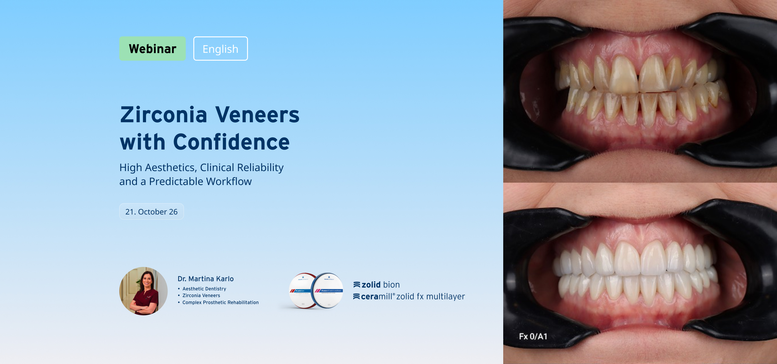 Webinar: Zirconia Veneers with Confidence: High Aesthetics, Clinical Reliability and a Predictable Workflow