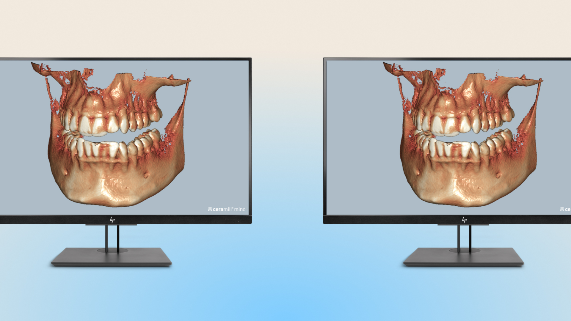 Ceramill Dicom-Viewer