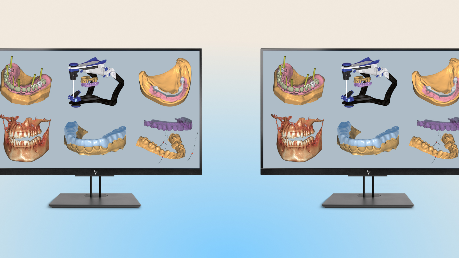 Ceramill Mind Master Bundle