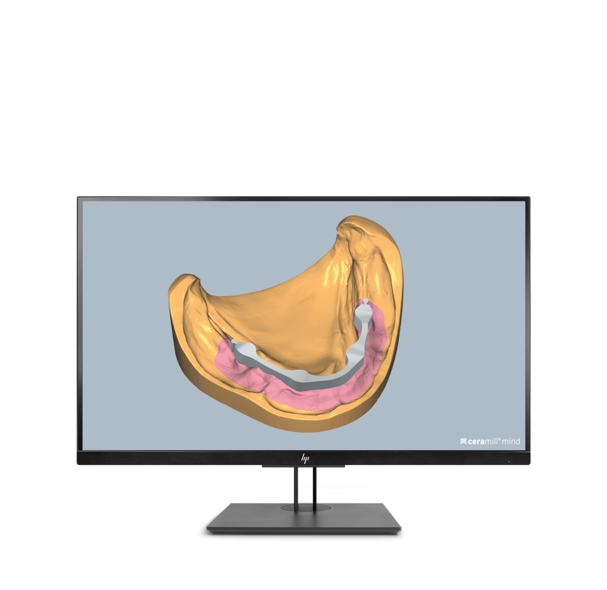 Ceramill M-Bars