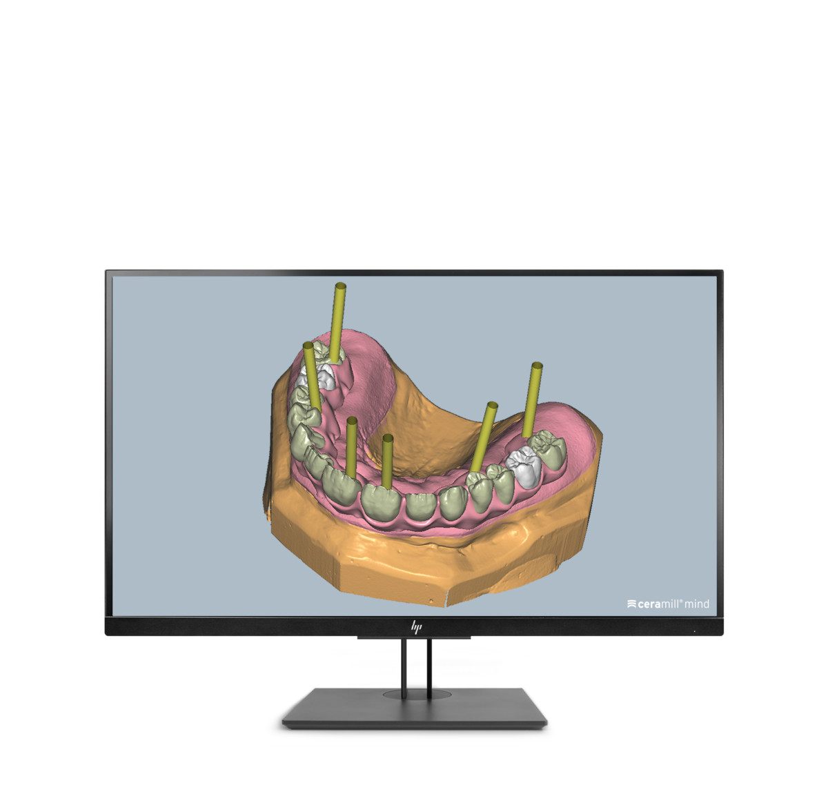 Ceramill M-Gin