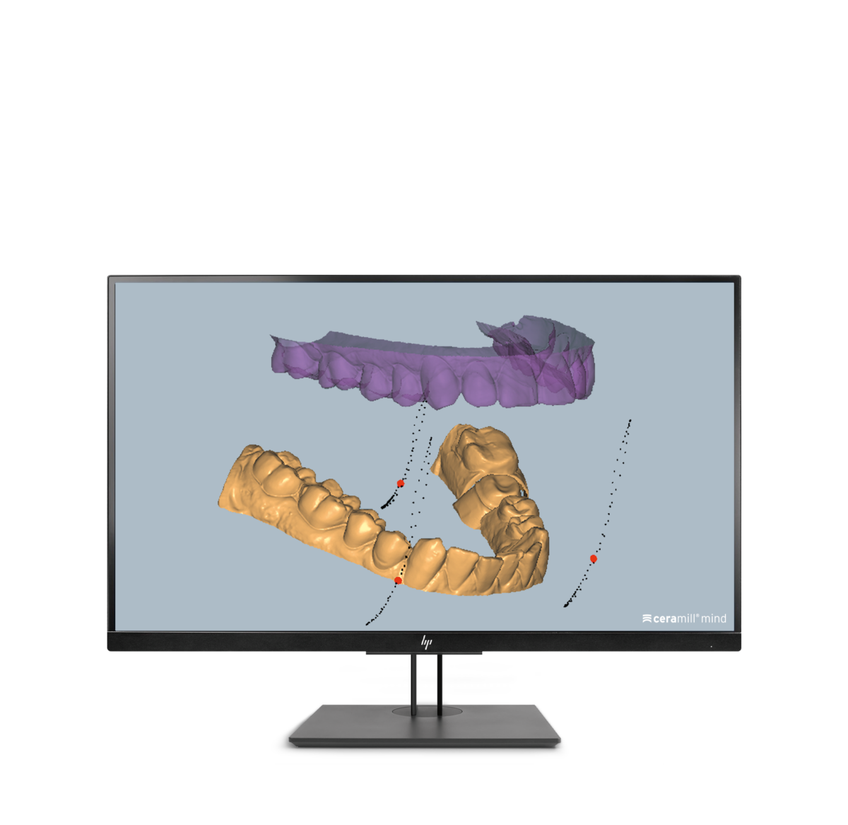 Ceramill M-Pass