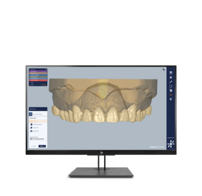 Ceramill Mind