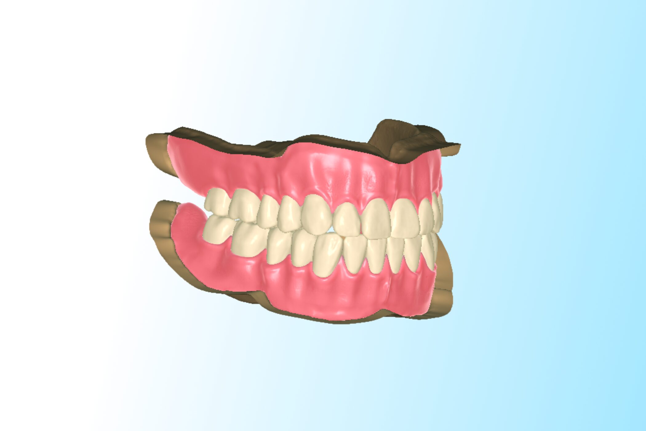 Design. Nest. Produce. Mastering the Digital Denture Workflow.