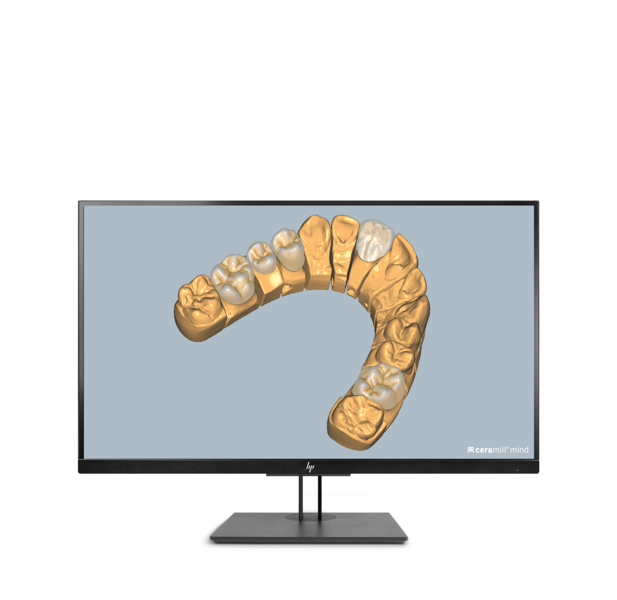 Ceramill Mindforms