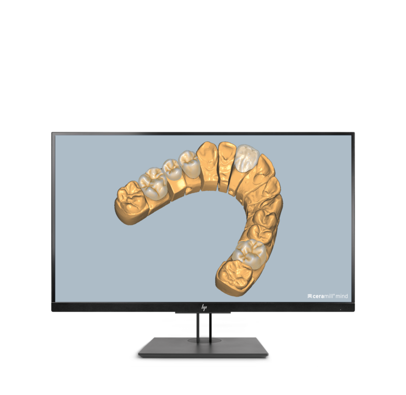 Ceramill Mindforms