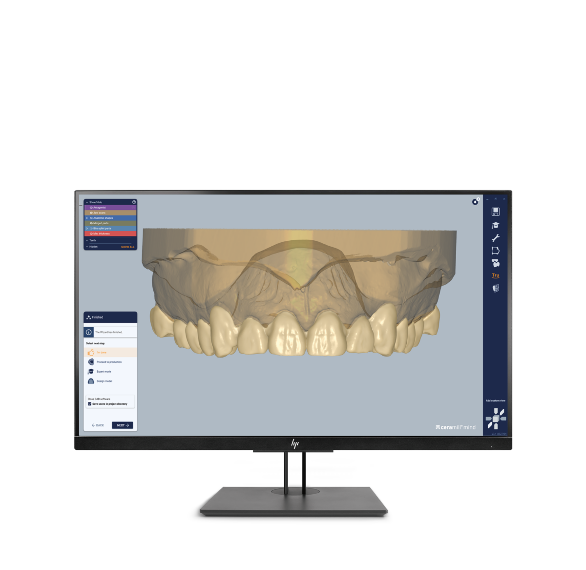 Ceramill Mind